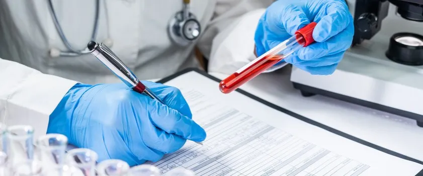 Zdjęcie RDW CV co to? Kluczowe informacje o znaczeniu i interpretacji