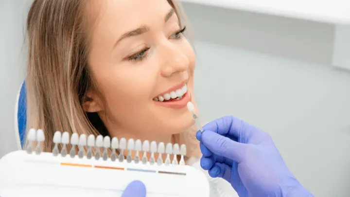 Zdjęcie Licówki na zęby co to jest i jak mogą odmienić Twój uśmiech