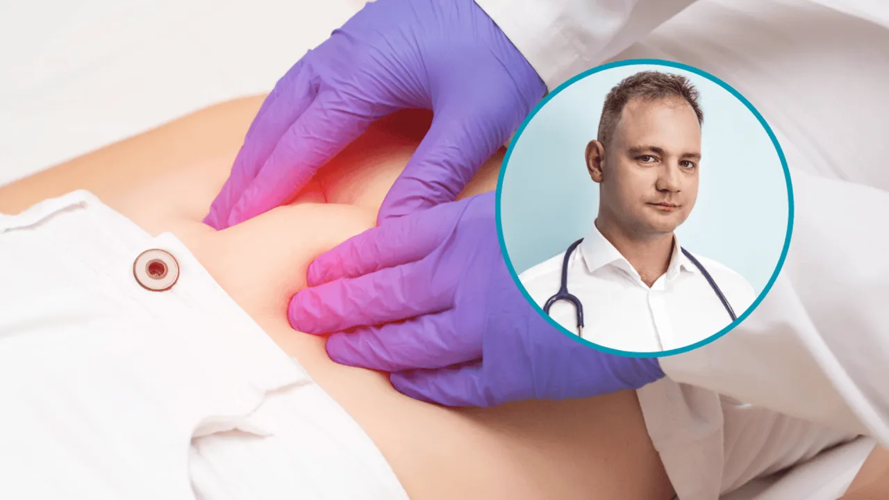 Zdjęcie Jakie leki na uchyłki jelita grubego mogą pomóc w leczeniu?