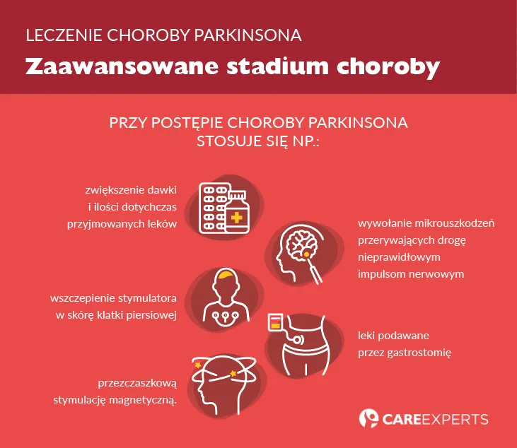 Zdjęcie Czy jest lek na Parkinsona? Aktualne metody leczenia i postępy