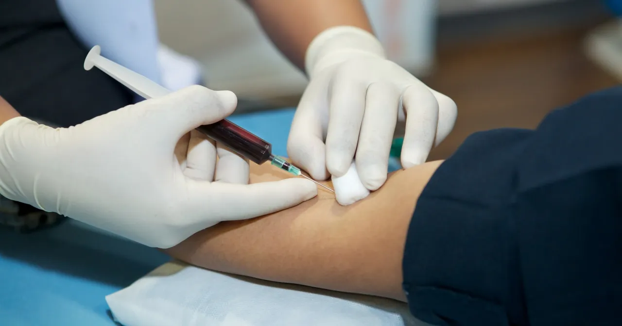 Zdjęcie Cholesterol czy na czczo? Sprawdź, co mówią nowe wytyczne