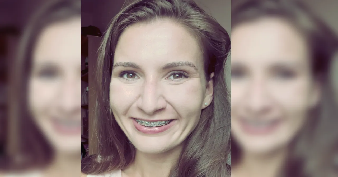 Zdjęcie Jak długo trzeba nosić aparat na zęby? Czas leczenia i ważne informacje