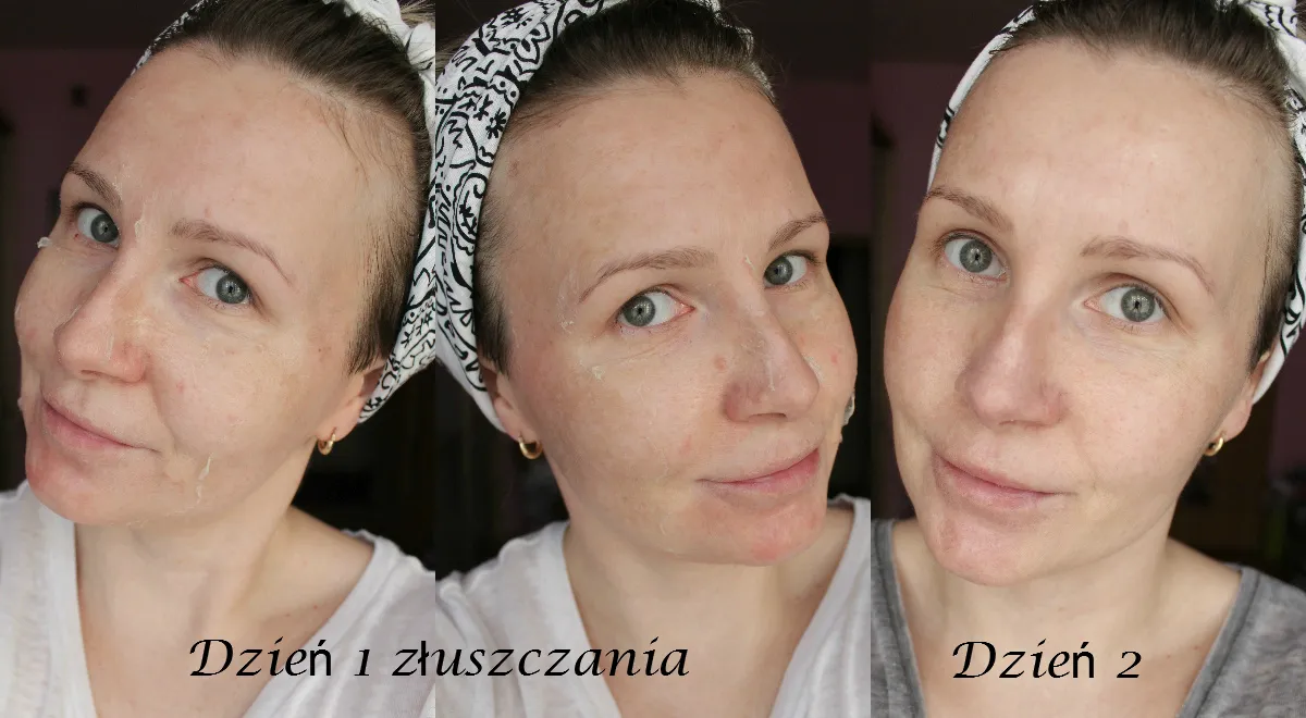 Zdjęcie Peeling przed czy po saunie: który wybór jest lepszy dla Twojej skóry?