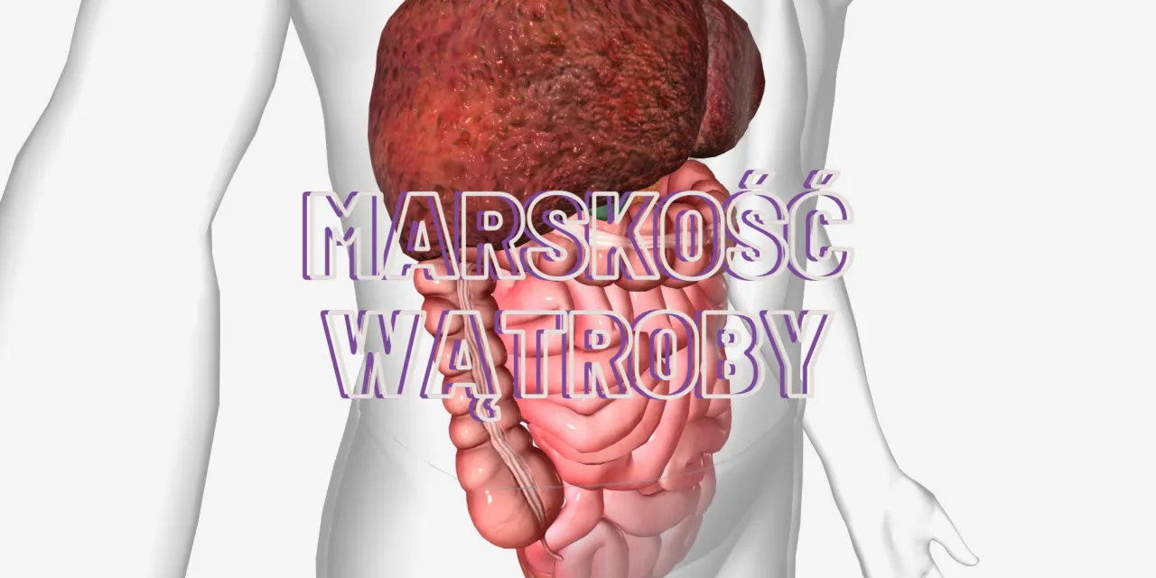 Zdjęcie Czy są leki na marskość wątroby? Poznaj skuteczne terapie i opcje leczenia