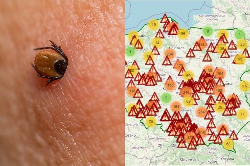 Zdjęcie Gdzie najczęściej są kleszcze? Miejsca, które warto unikać