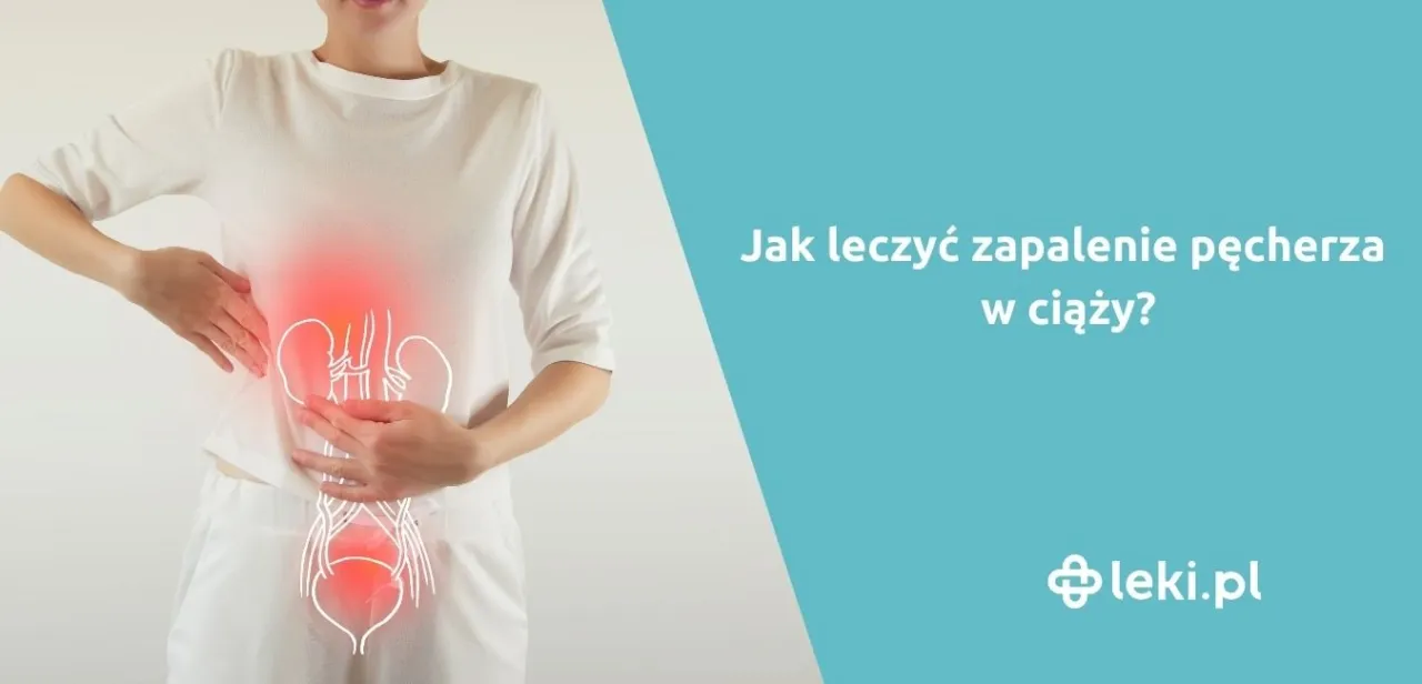 Zdjęcie Skuteczne sposoby na pęcherz w ciąży - bezpieczne leczenie