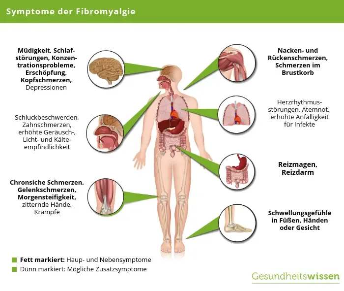 Zdjęcie Fibromyalgie neurologische Symptome: Verborgene Anzeichen erkennen und bewältigen