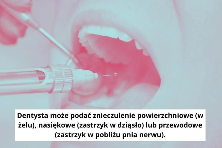 Zdjęcie Czy zastrzyk w dziąsło boli? Jak uniknąć bólu podczas zabiegu stomatologicznego