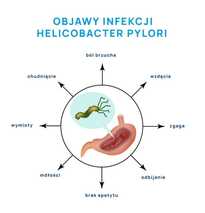 Zdjęcie Jakie leki na helicobacter pylori skutecznie leczą zakażenie i wrzody?