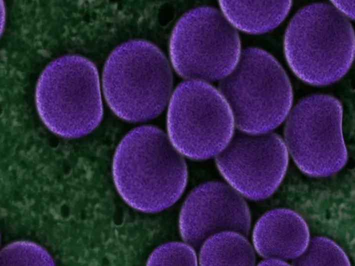 Zdjęcie Lactobacillus plantarum 299v w terapii SIBO: Efekty i zastosowanie