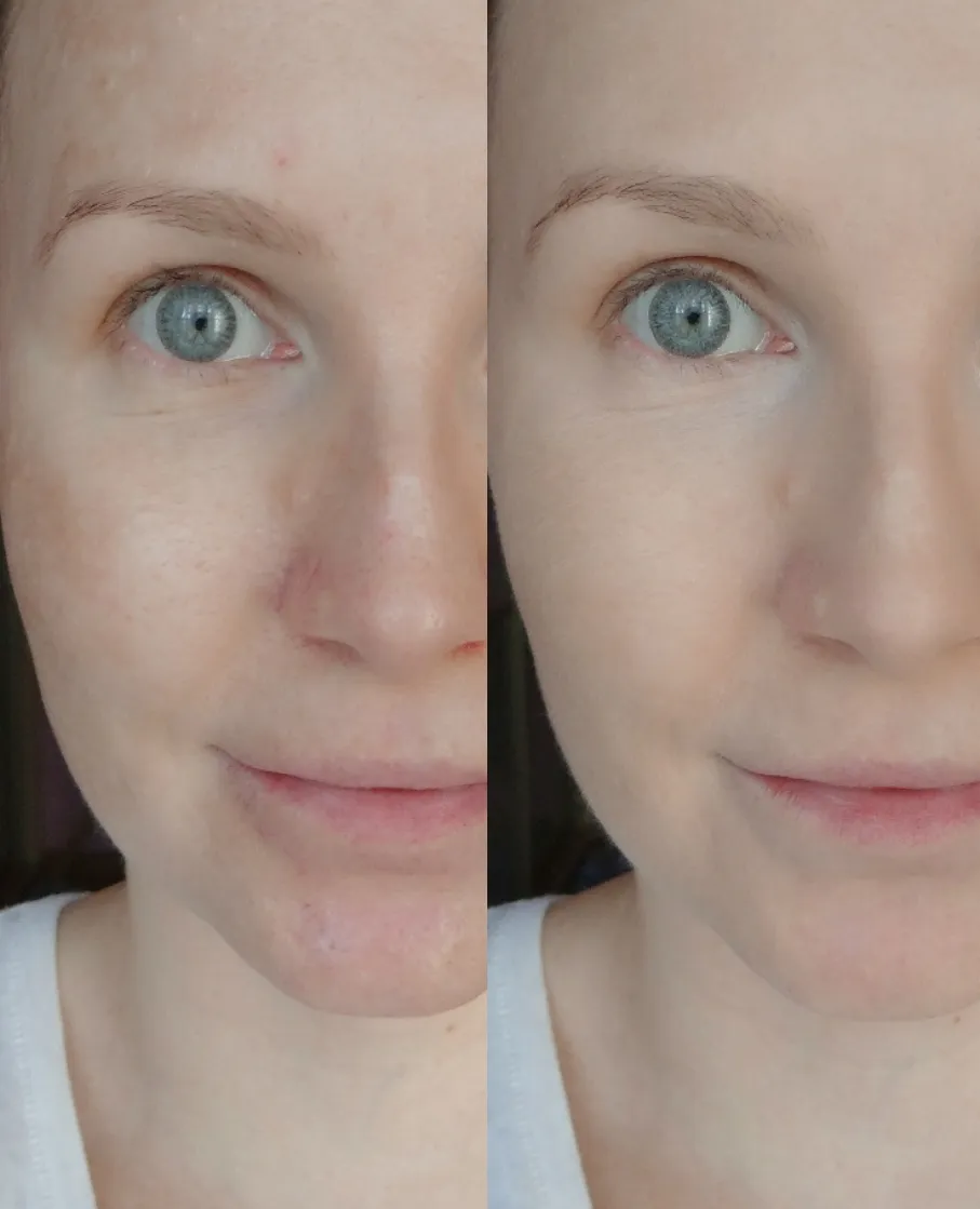 Zdjęcie Peeling przed czy po depilacji? Kluczowa kolejność zabiegów