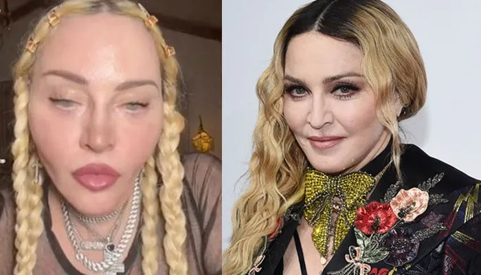 Zdjęcie Madonna: Triumfalny powrót Królowej Popu w trasie koncertowej
