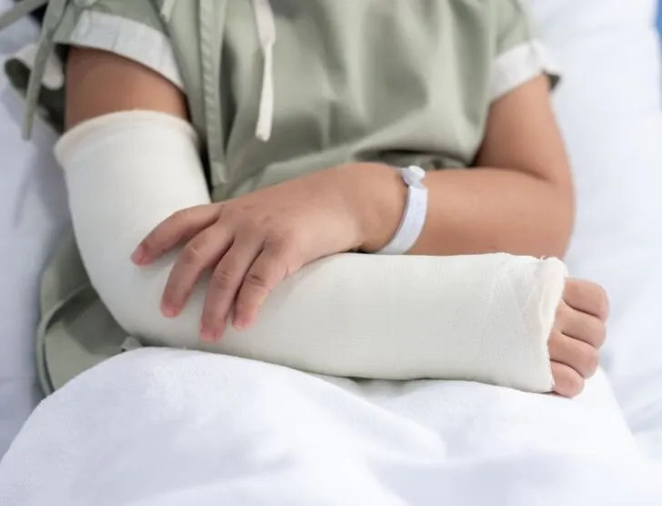 Zdjęcie Złamana ręka – ile czasu trzeba nosić gips i co dalej?