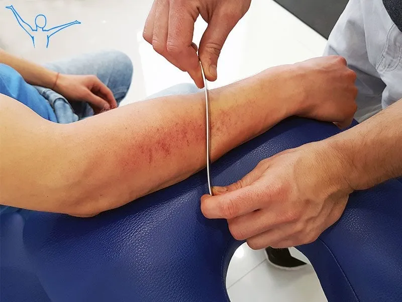 Zdjęcie Co to jest mobilizacja w rehabilitacji i jak może zmienić twoje życie