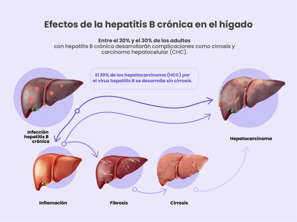 Zdjęcie ¿Hepatitis B? Síntomas clave y cuándo actuar para proteger tu hígado