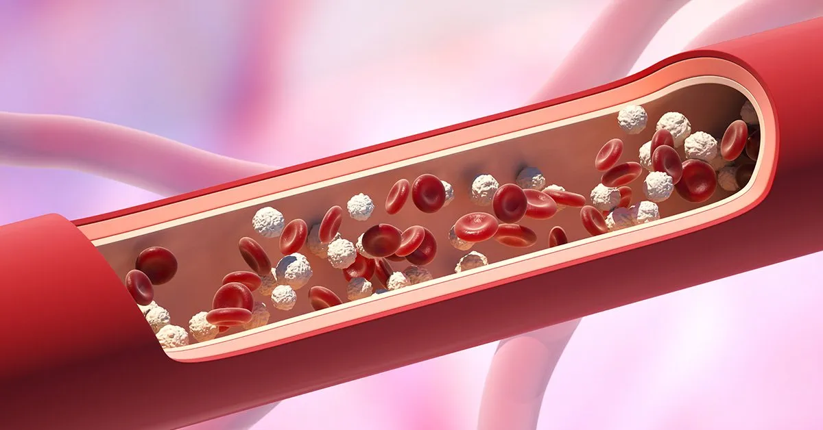 Zdjęcie Zu viele weiße Blutkörperchen Symptome: Warnsignale, die Sie kennen müssen