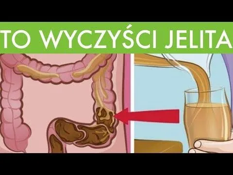 Zdjęcie Co jest dobre na jelita? Odkryj najlepsze produkty wspierające zdrowie