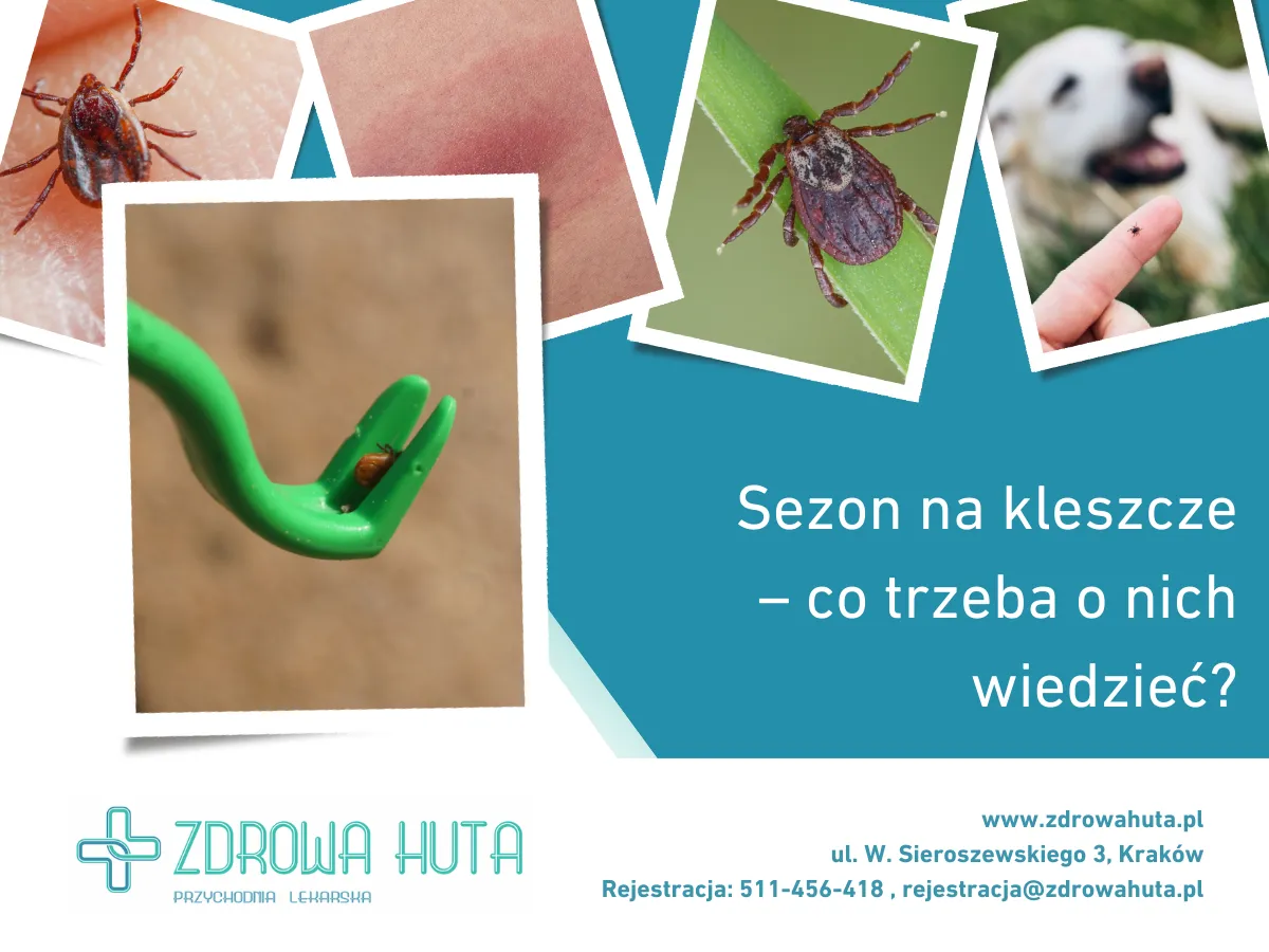 Zdjęcie Sezon na kleszcze kiedy: uniknij ukąszeń i zagrożeń zdrowotnych
