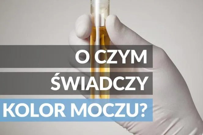 Zdjęcie Jakie badanie moczu do urologa? Dowiedz się, co może wykryć