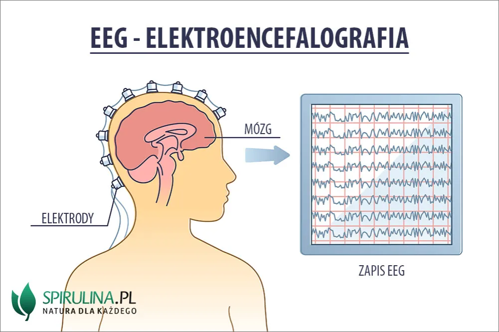 Zdjęcie Co bada EEG? Wszystko o elektroencefalografii i jej zastosowaniach
