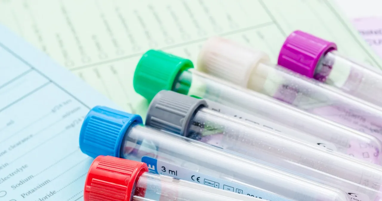 Zdjęcie Skierowanie do laboratorium ile ważne? Sprawdź, by uniknąć problemów