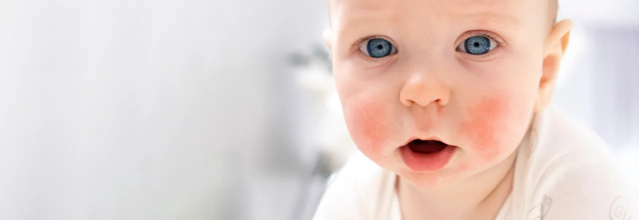 Zdjęcie Czy kakao uczula niemowlę? Dowiedz się, jak uniknąć alergii