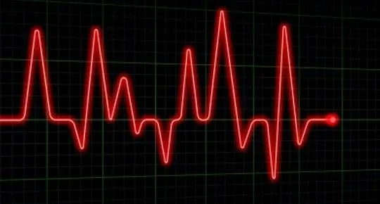 Zdjęcie Prawidłowy puls podczas snu: Co mówią normy i objawy?