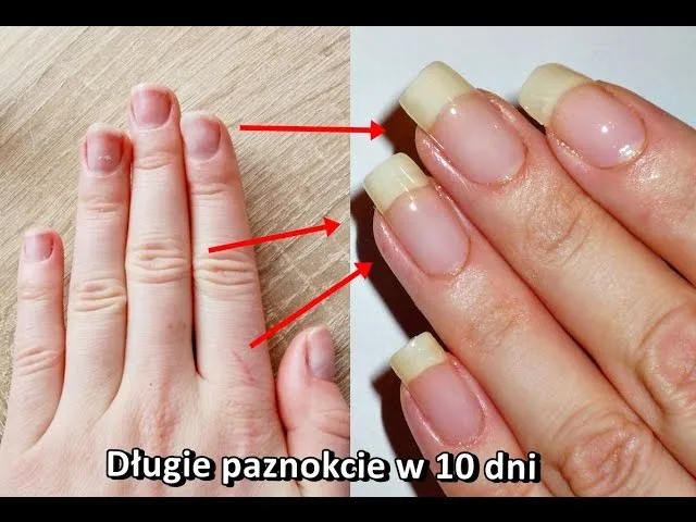 Zdjęcie Jak szybko zapuścić paznokcie? Skuteczne metody na piękne dłonie
