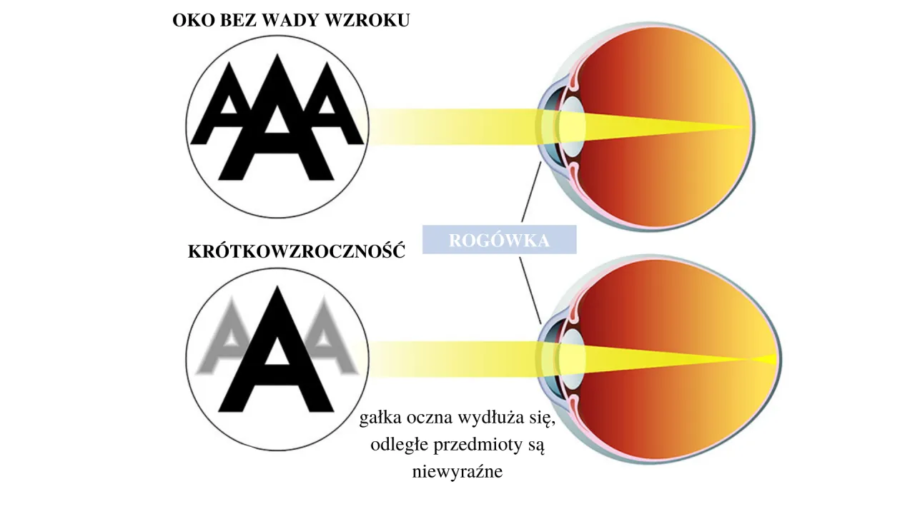 Zdjęcie Jak poprawić ostrość wzroku i uniknąć problemów z widzeniem na co dzień