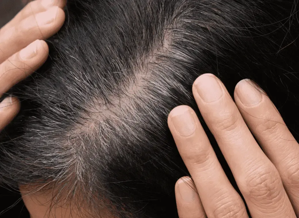 Zdjęcie Jak przyciemnić odrost i ukryć je skutecznie bez farbowania