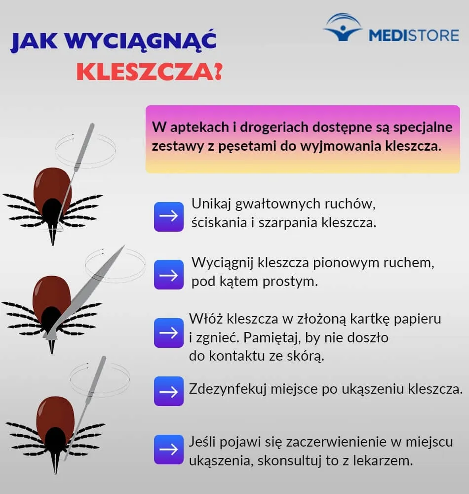 Zdjęcie Jak usunąć kleszcza u kota? Bezpieczne metody i ważne wskazówki