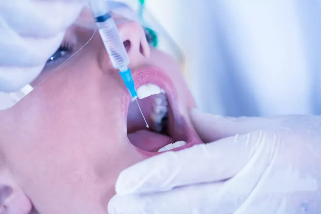 Zdjęcie Jak długo działa znieczulenie od dentysty? Co musisz wiedzieć o bólu