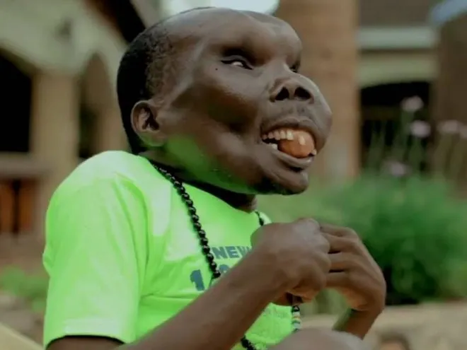 Zdjęcie Najbrzydszy chłopak świata: Kim jest i dlaczego jest znany?