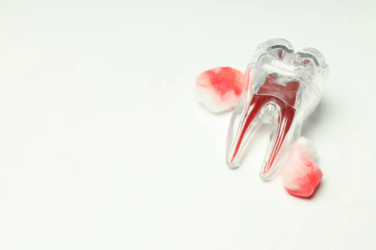 Zdjęcie Utrata skrzepu po wyrwaniu zęba? Dowiedz się, co robić!