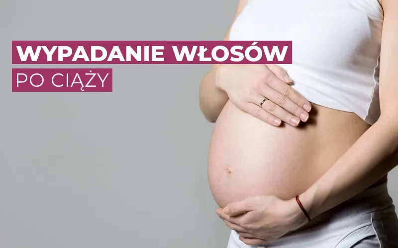 Zdjęcie Ile czasu wypadają włosy po porodzie? Odpowiedzi, które zaskoczą każdą mamę