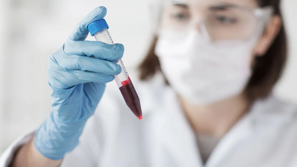 Zdjęcie Podwyższony poziom androstendionu: przyczyny, objawy i diagnostyka