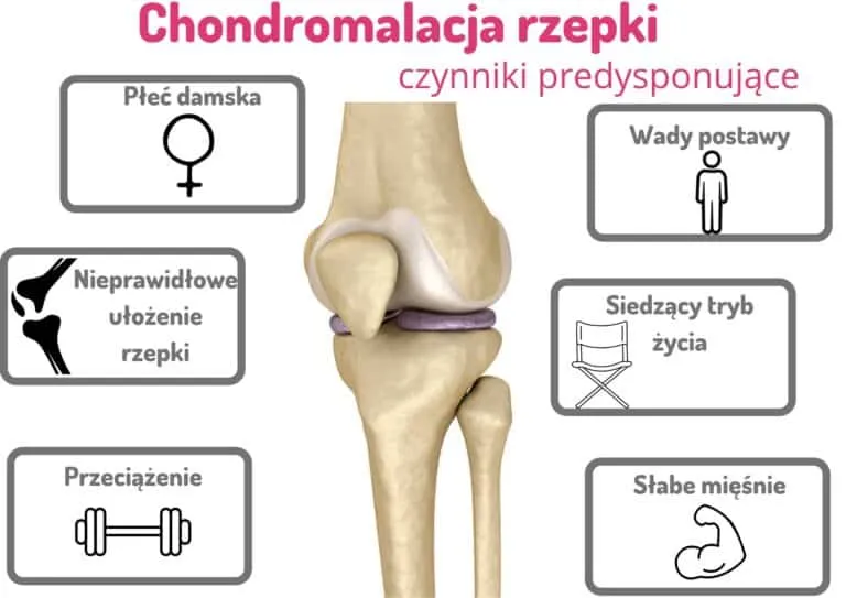 Zdjęcie Chondromalacja rzepki: jakich ćwiczeń unikać, by nie pogorszyć stanu kolan