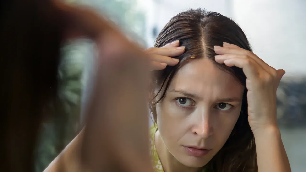 Zdjęcie Dünnes Haar und sichtbare Kopfhaut bei Frauen: Ursachen und Lösungen