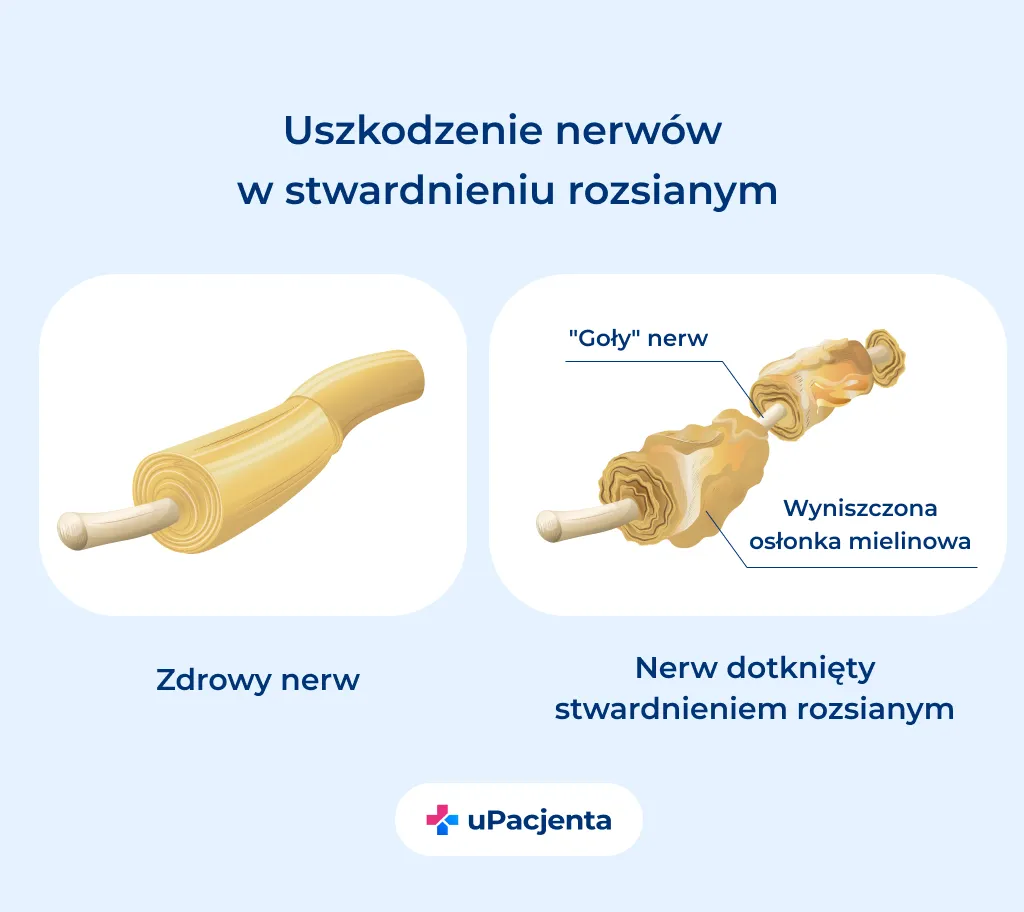 Zdjęcie Film o stwardnieniu rozsianym: jak Nie jesteś sobą ukazuje prawdę o chorobie