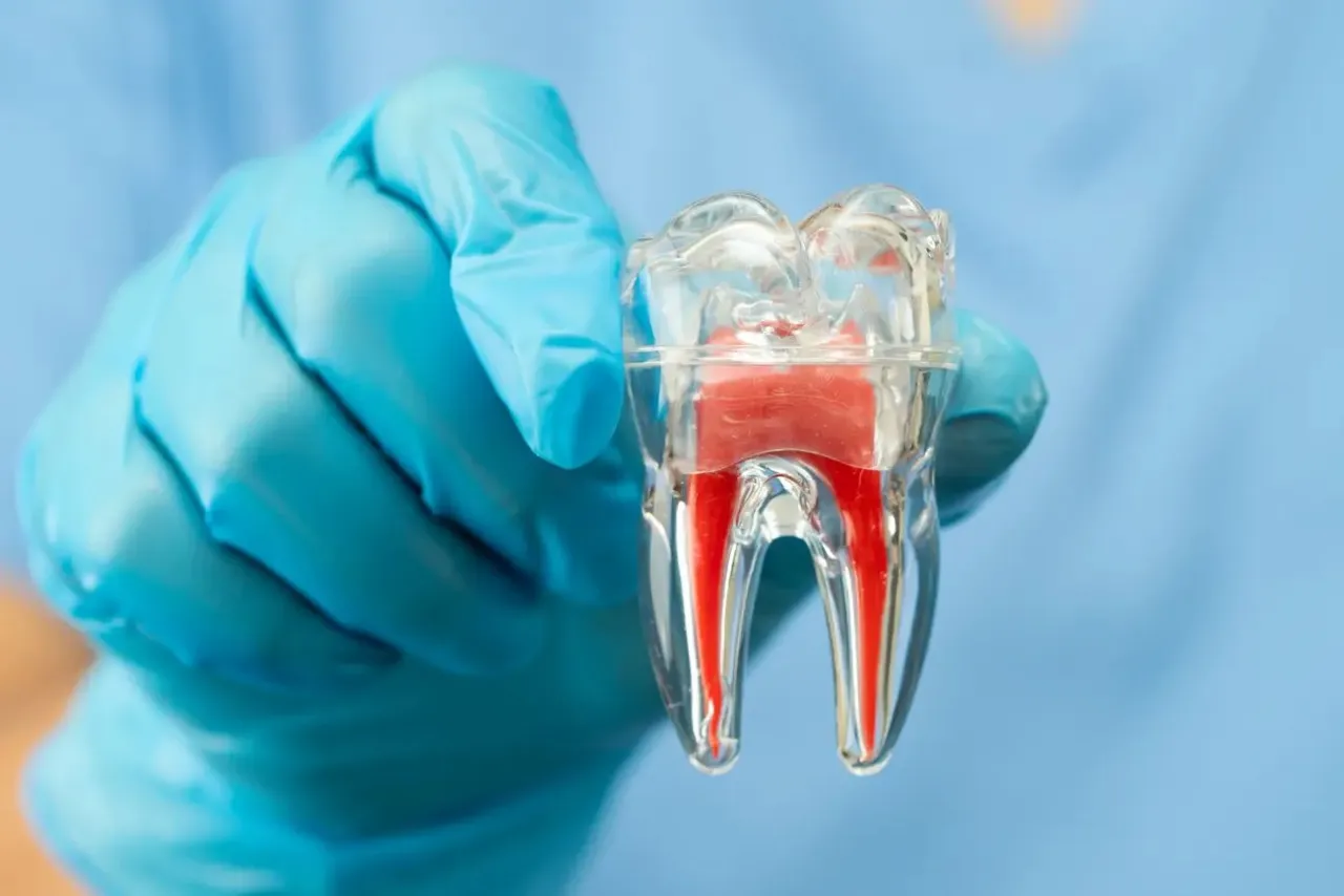 Zdjęcie Czy po leczeniu kanałowym można ćwiczyć? Ważne wskazówki dla zdrowia