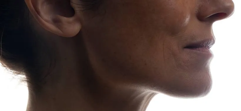 Zdjęcie Schlaffe Gesichtshaut: Ursachen erkennen und wirksam straffen