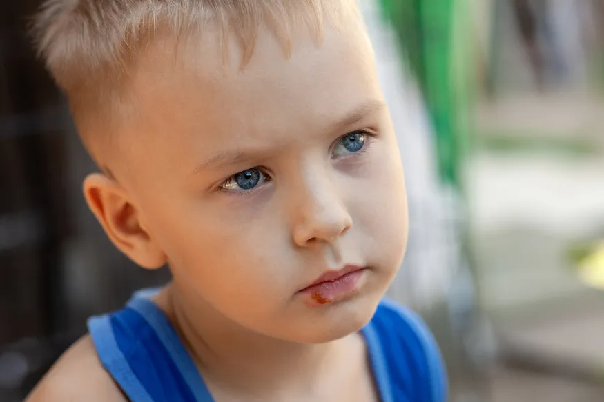Zdjęcie Czy dziecko z opryszczką może iść do przedszkola? Sprawdź, co robić