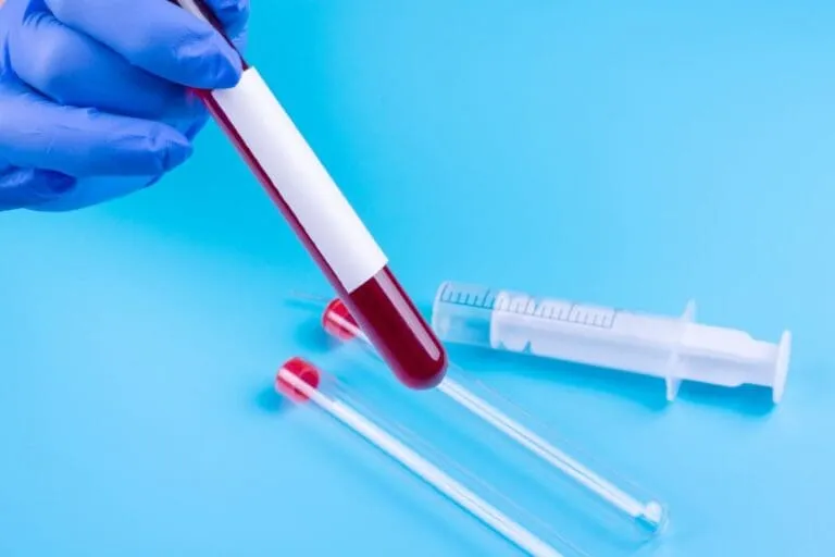 Zdjęcie Jak wyglądają badania hormonalne i co warto o nich wiedzieć?