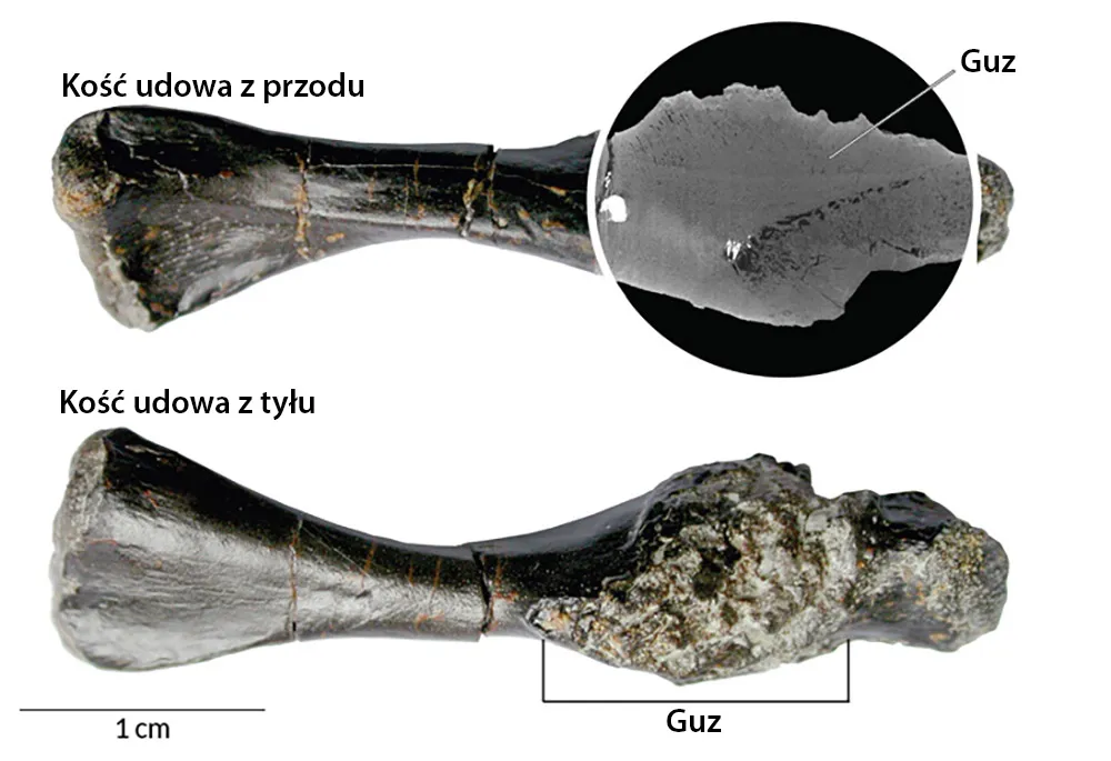Zdjęcie Kiedy odkryto raka? Historia, która zaskakuje i inspiruje