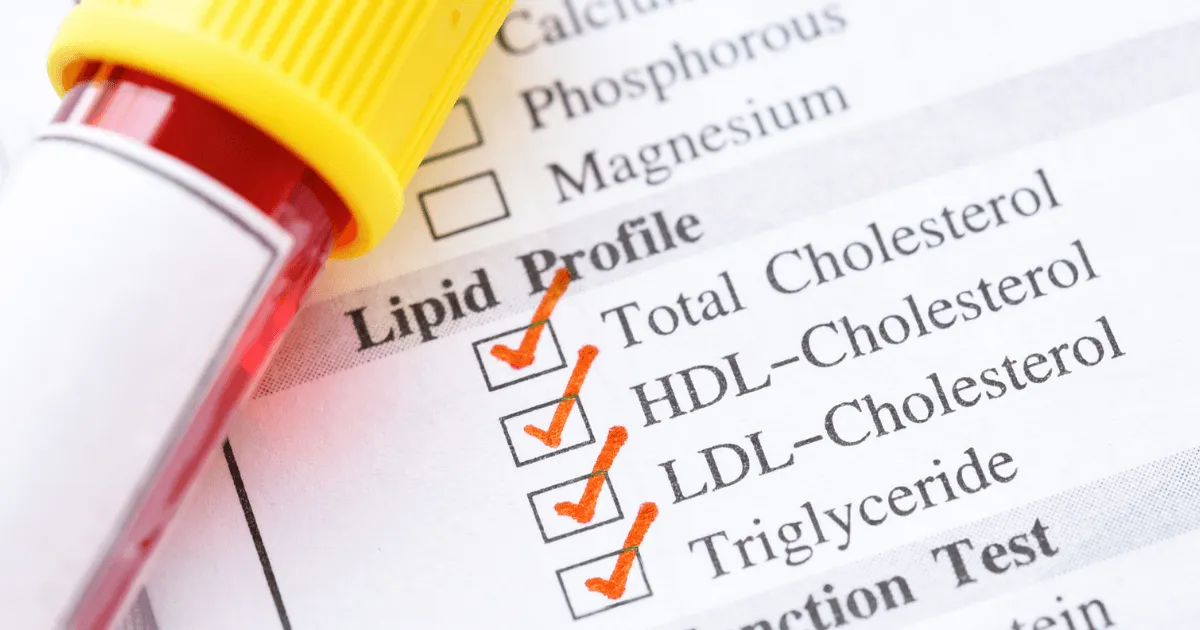 Zdjęcie Jaki powinien być cholesterol całkowity, aby uniknąć problemów zdrowotnych?