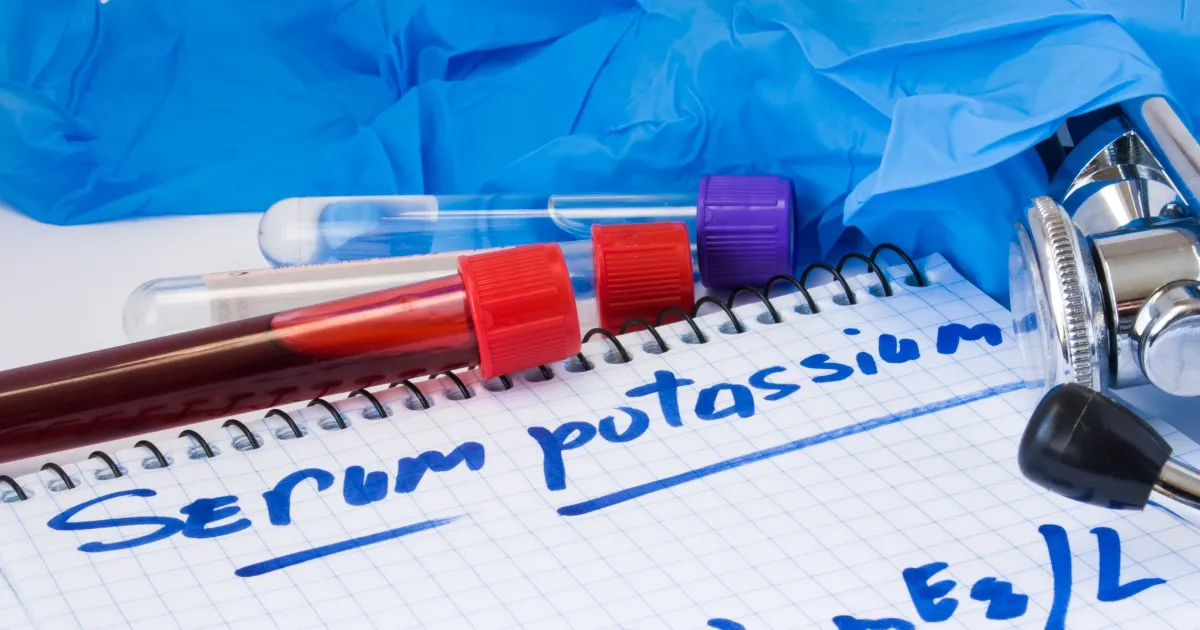 Zdjęcie Podwyższony poziom potasu co oznacza i jakie niesie zagrożenia zdrowotne