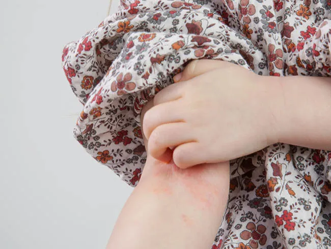 Zdjęcie Czy badanie mykologiczne jest refundowane? Sprawdź warunki NFZ