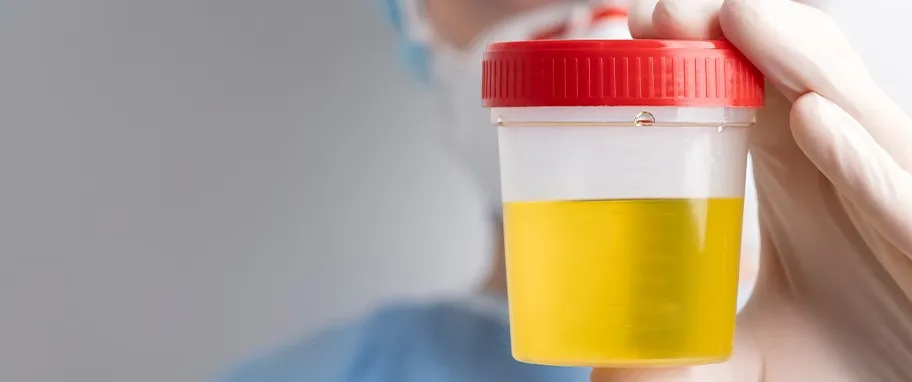 Zdjęcie Leukocyty w moczu – co oznaczają i kiedy mogą wskazywać na chorobę?