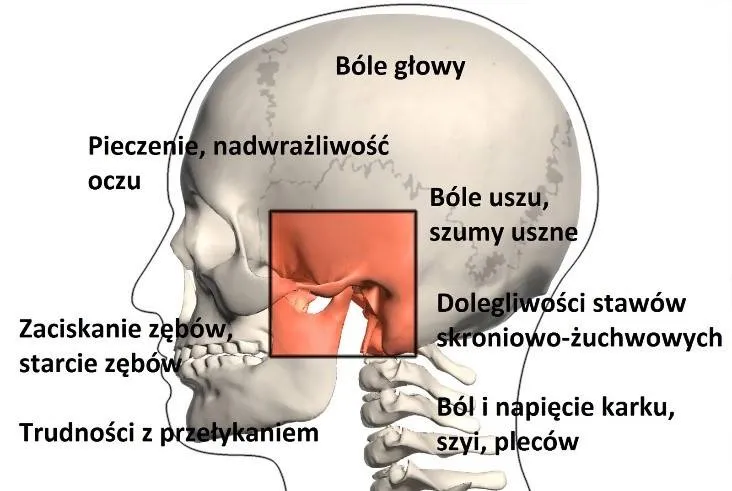 Zdjęcie Ból stawu skroniowo-żuchwowego - do jakiego lekarza się udać?