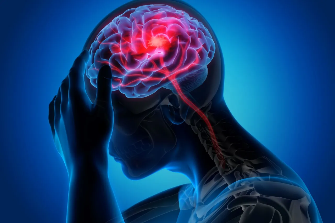 Zdjęcie PFO objawy neurologiczne: Jak unikać ryzyka udaru mózgu?